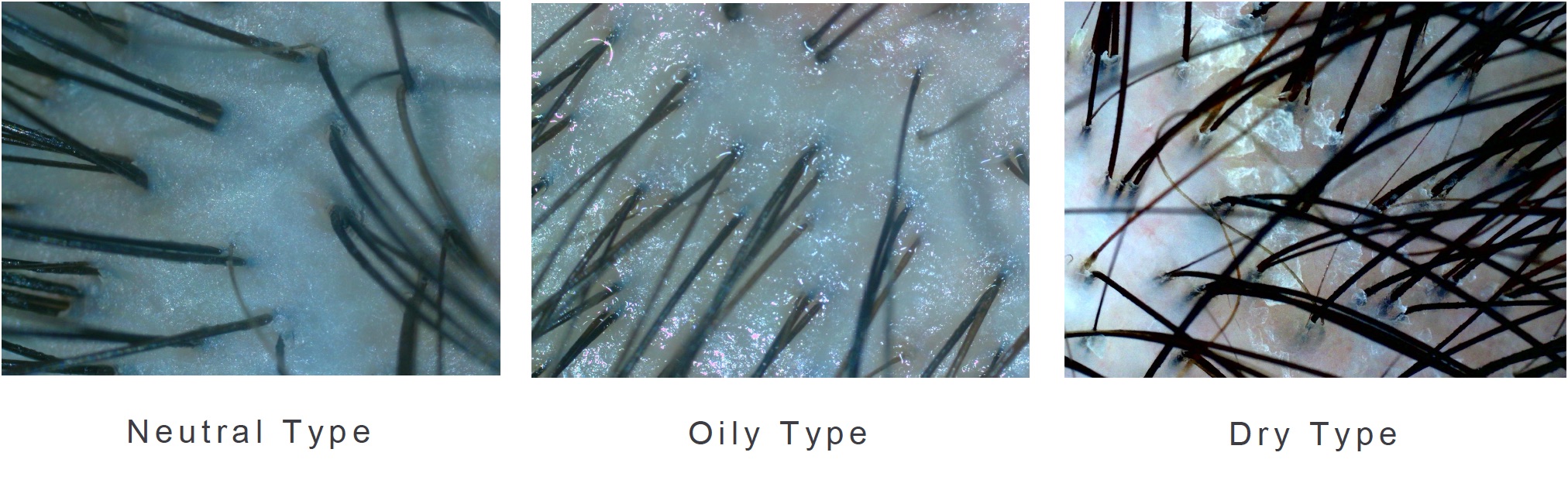 Scalp Condition Detection