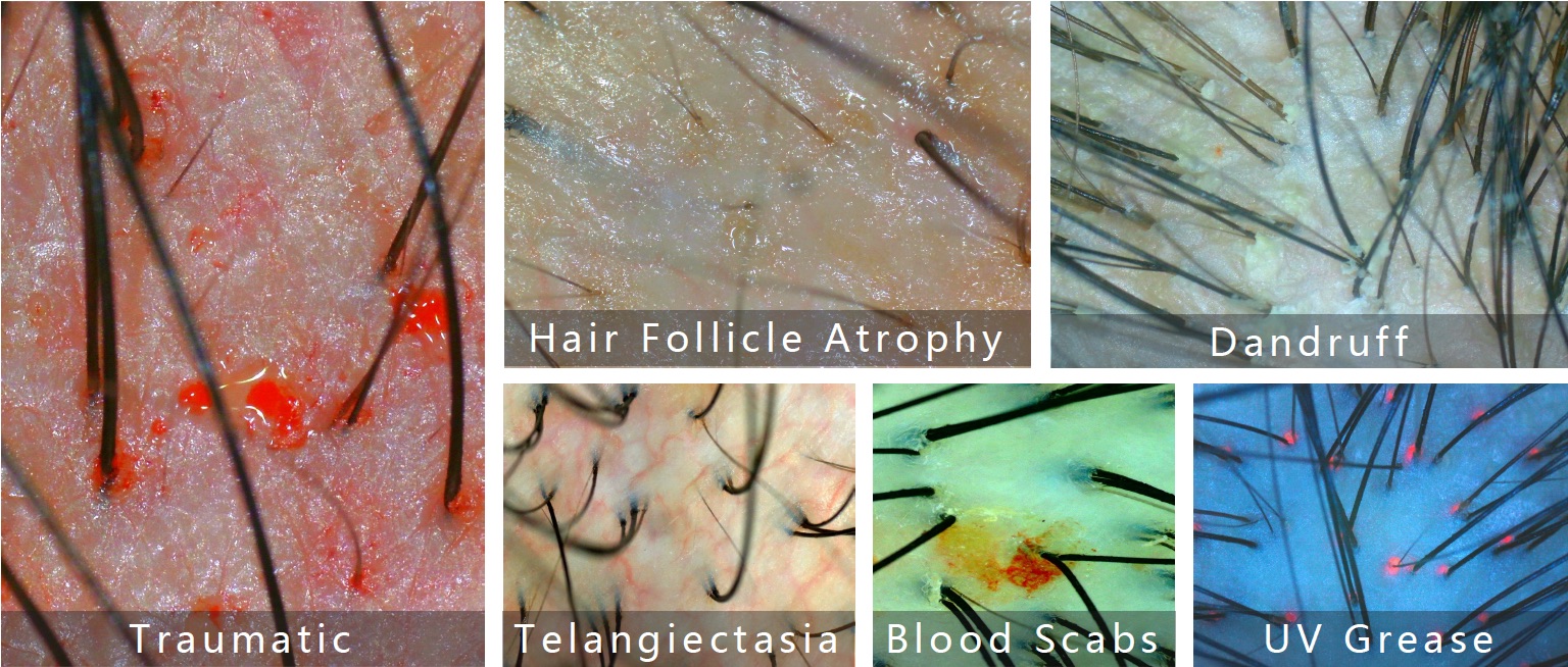 Skin Type Evaluation 3