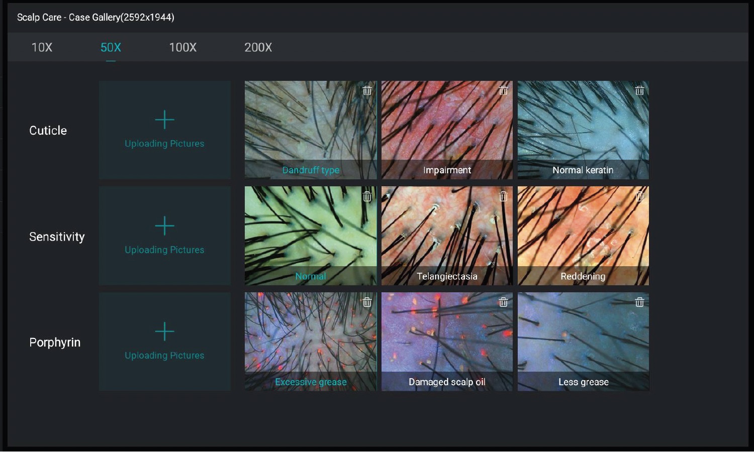 Skin Type Evaluation 5